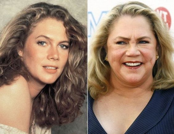 Kathleen Turner