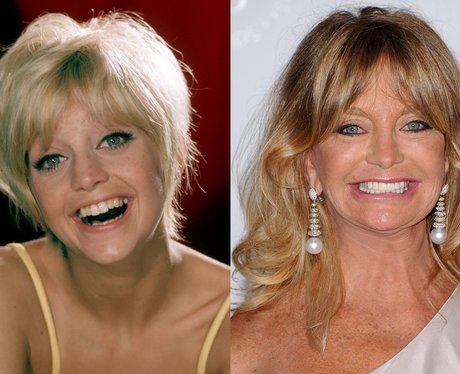 Goldie Hawn