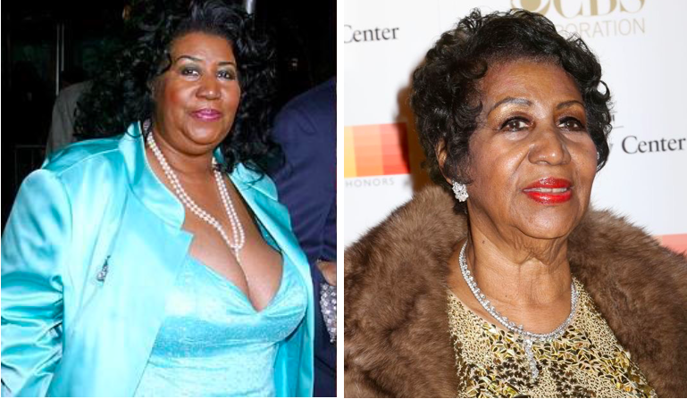 Aretha Franklin - 85 Lbs. Loss