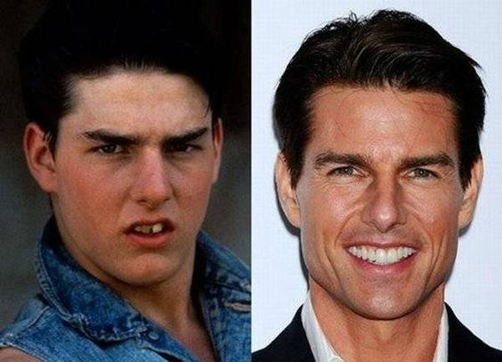 Tom Cruise