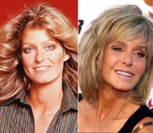 Farrah Fawcett