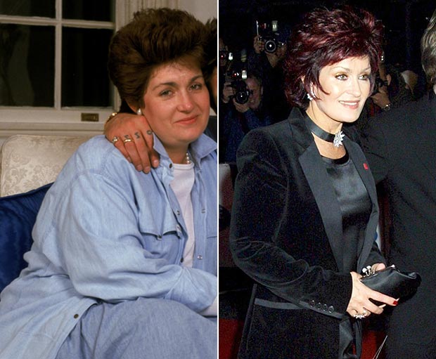 Sharon Osbourne - 100 Lbs. Loss