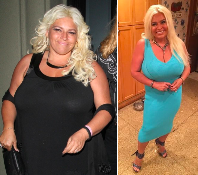 Beth Chapman